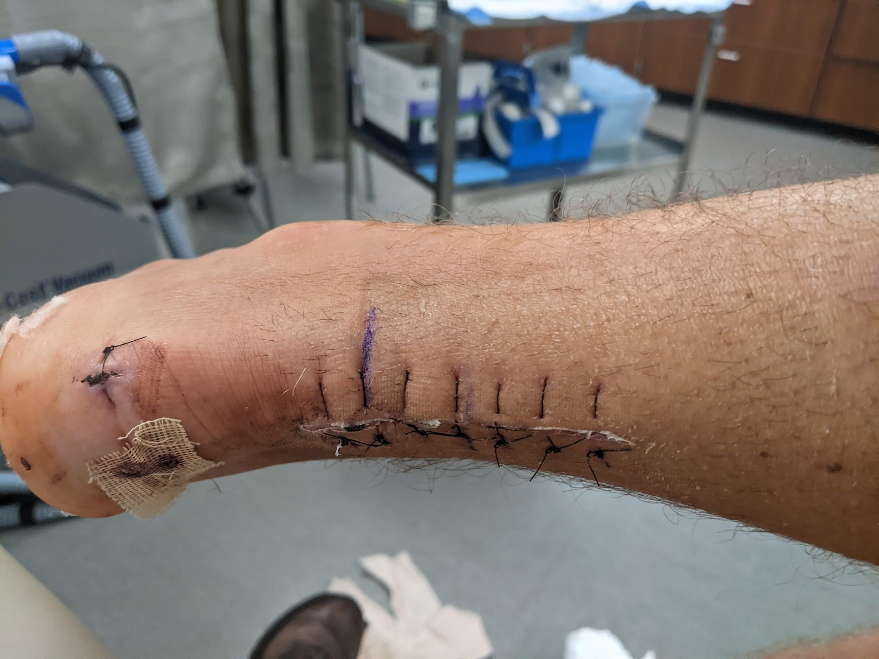 cast off