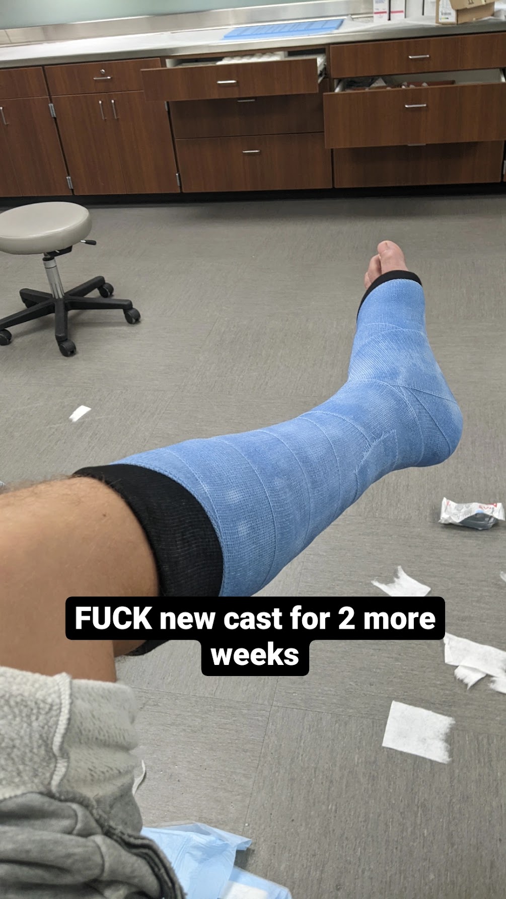 blue cast